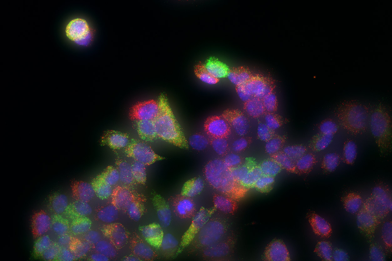 Imaging of individual breast cancer tumor cells
