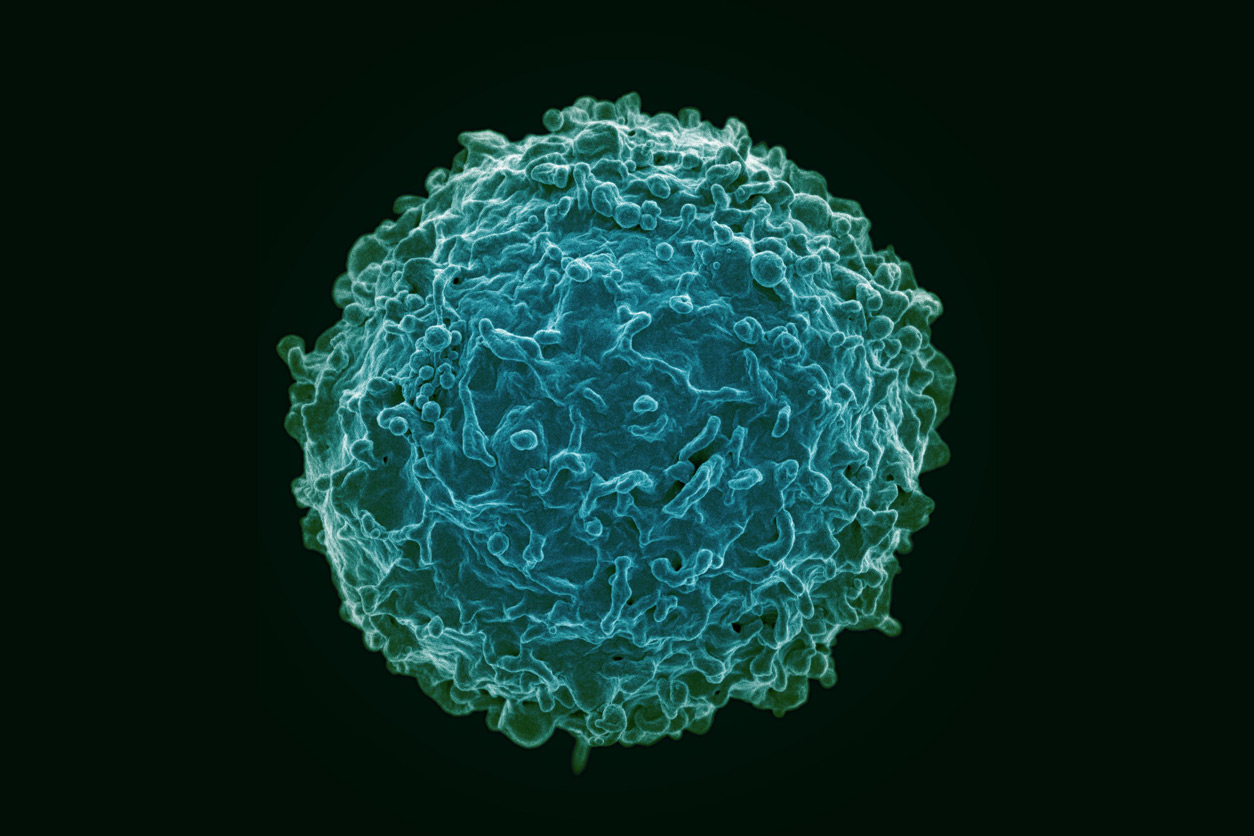 colorized scanning electron micrograph of a B-cell from a human donor