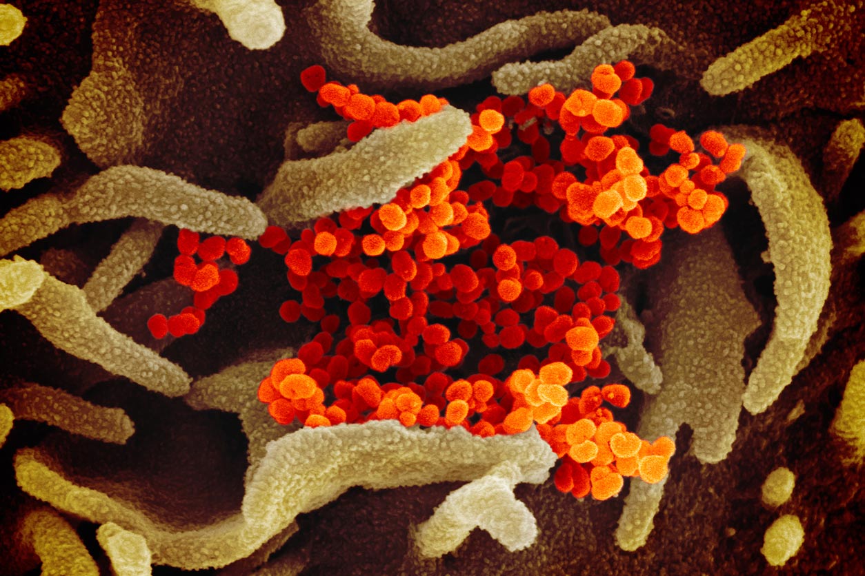 electron microscope image of SARS-CoV-2
