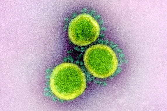 close up of coronas of coronaviruses from a transmission electron micrograph of virus particles
