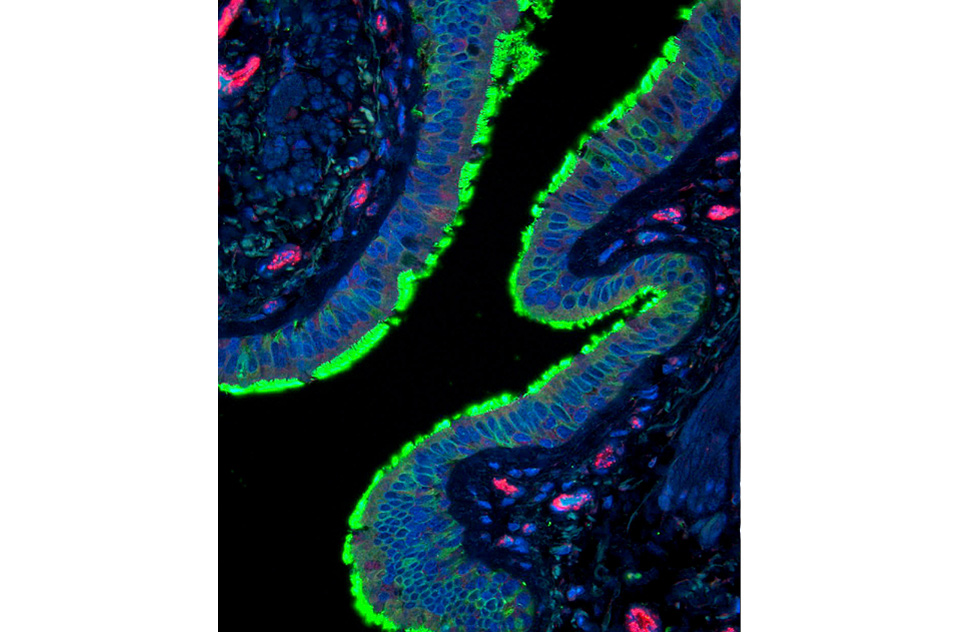 Cilia expression on epithelial cells in a human lung section