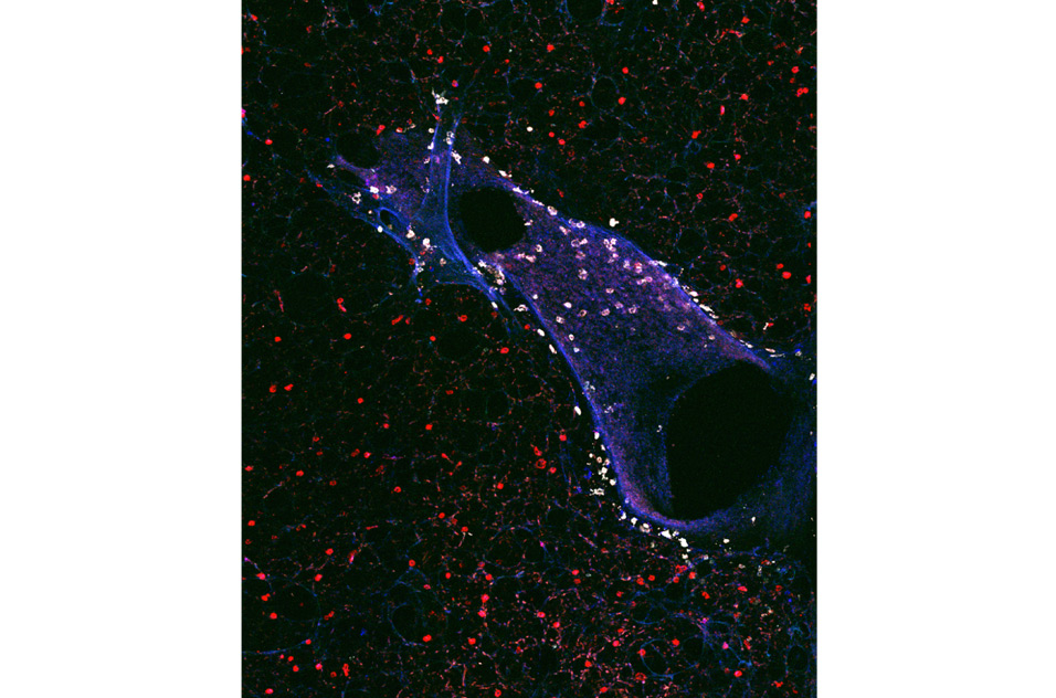 mouse airway with associated dendritic cells