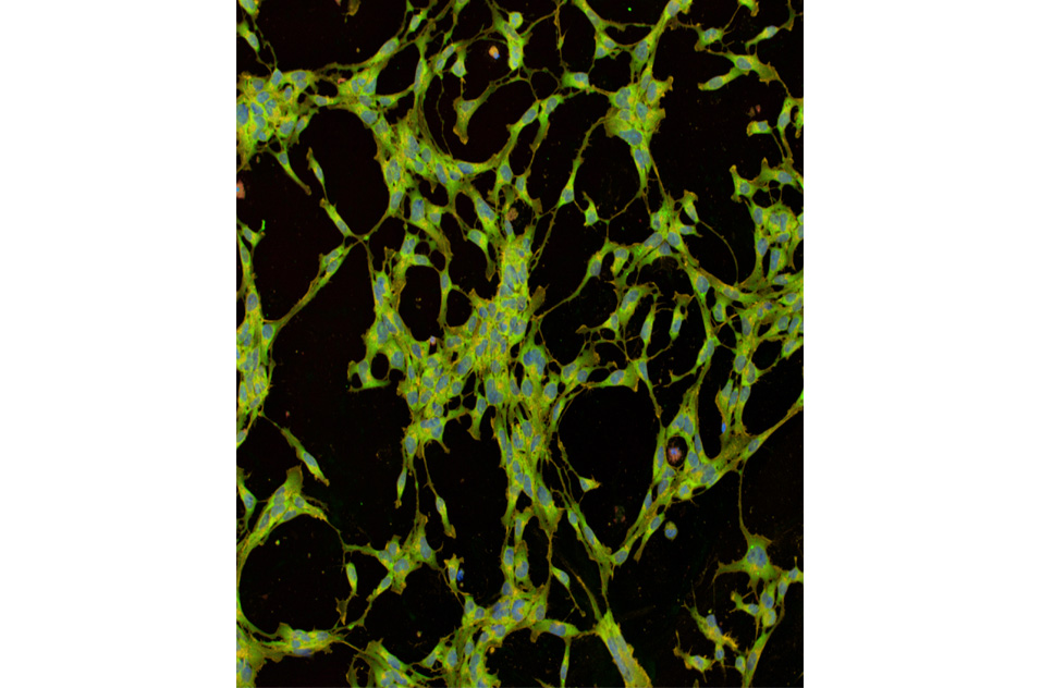 mouse neural progenitor cells stained with six fluorescent dyes