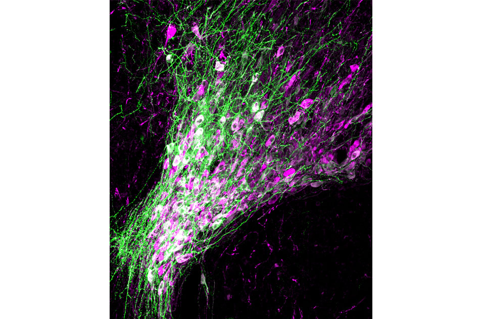 noradrenergic neurons in the hindbrain nucleus of the brain