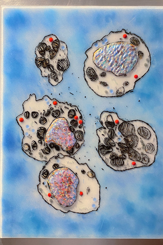 Alveolar Type 2 Cells by Teddy Devereux