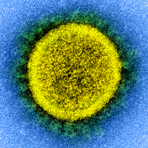 transmission electron micrograph of a SARS-CoV-2 virus particle
