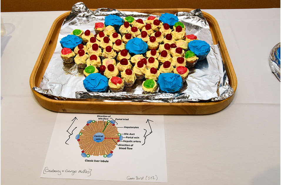 A collaboration of cupcakes illustrating an aspect of liver anatomy.