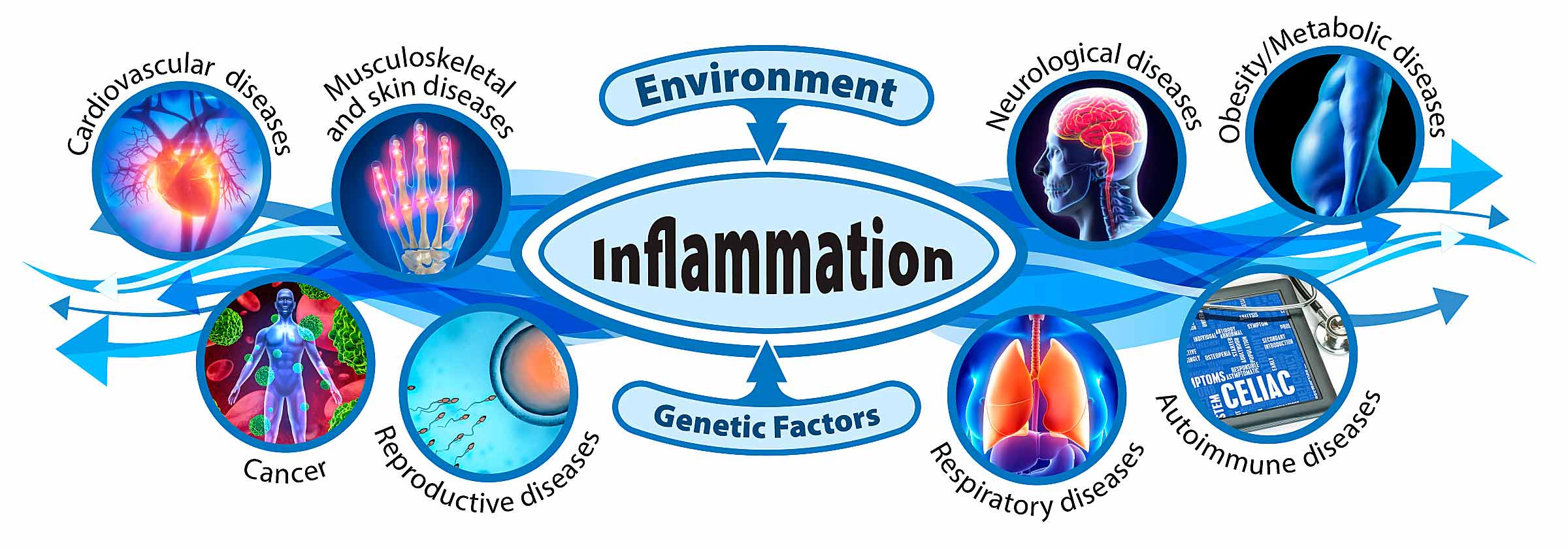 graphical representation of environmental and genetic factors contributing to various inflammatory states