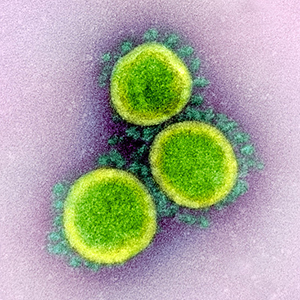 close up of coronas of coronaviruses from a transmission electron micrograph of virus particles