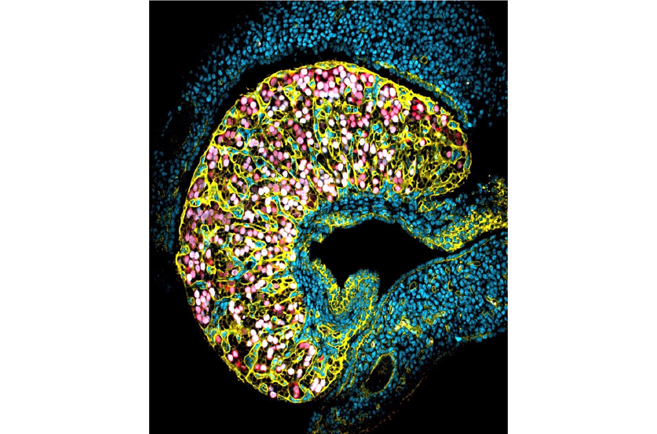 mouse fetal ovary where future oocytes are enclosed in nests by a basal membrane that separates them from the interstitial cells