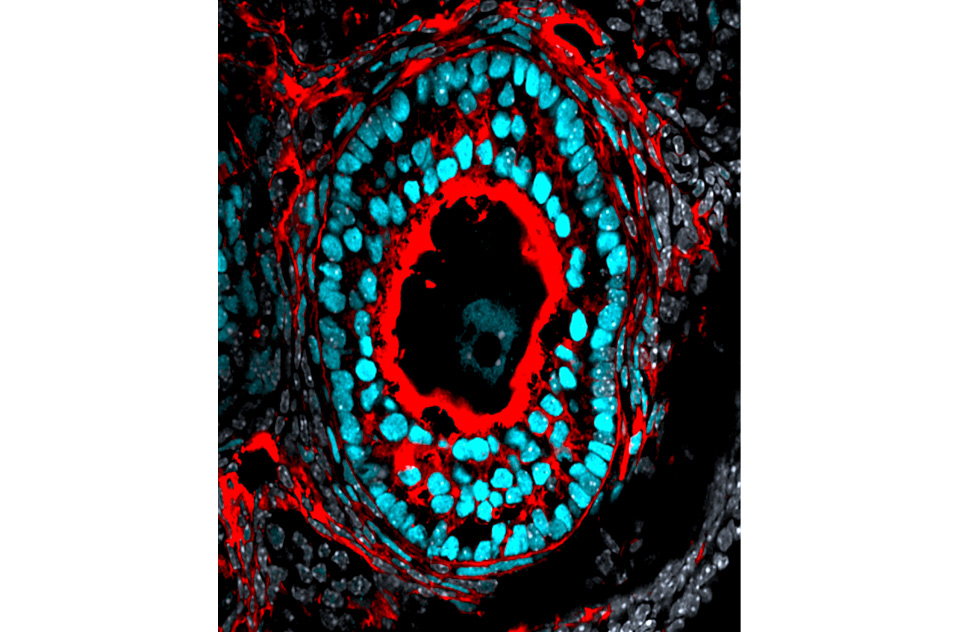 cell types in adult ovary preantral follicle