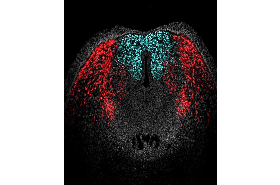 Cross section of embryonic mouse external genitalia