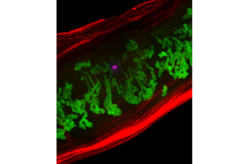 mouse uterus during the window of implantation