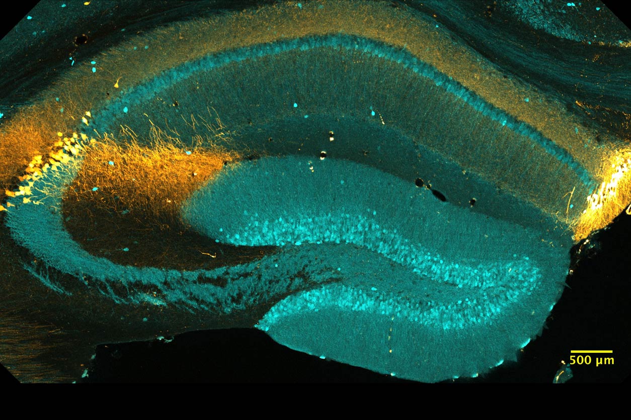 coronal section of a mouse brain hippocampal area CA2