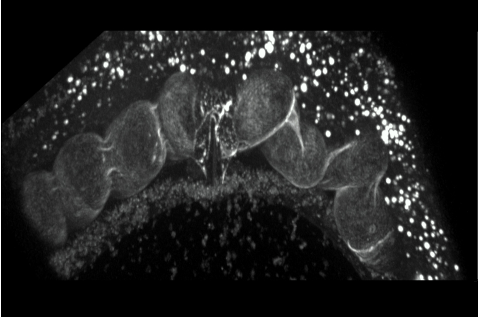 confocal microscopy of a live Caenorhabditis elegans worm