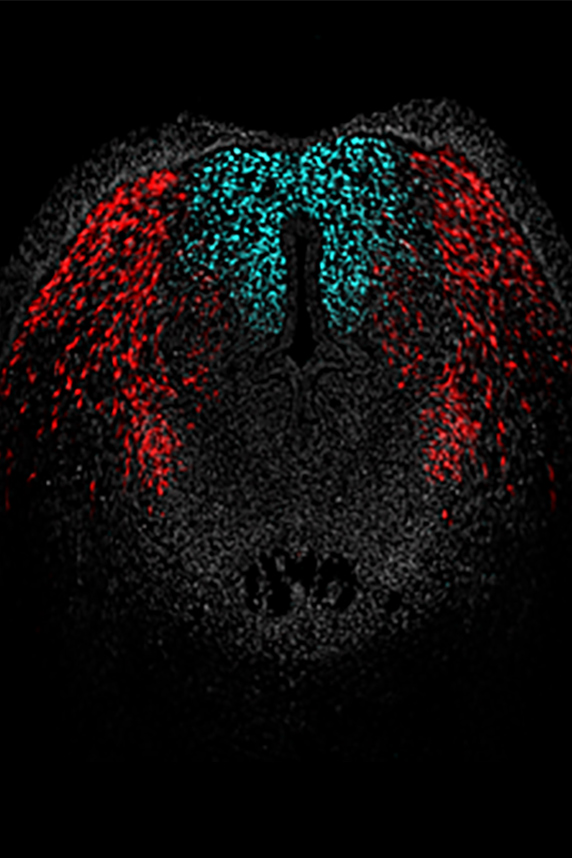 cross section of embryonic mouse external genitalia