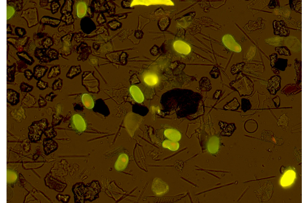 Alexandrium catenella cysts in sediment