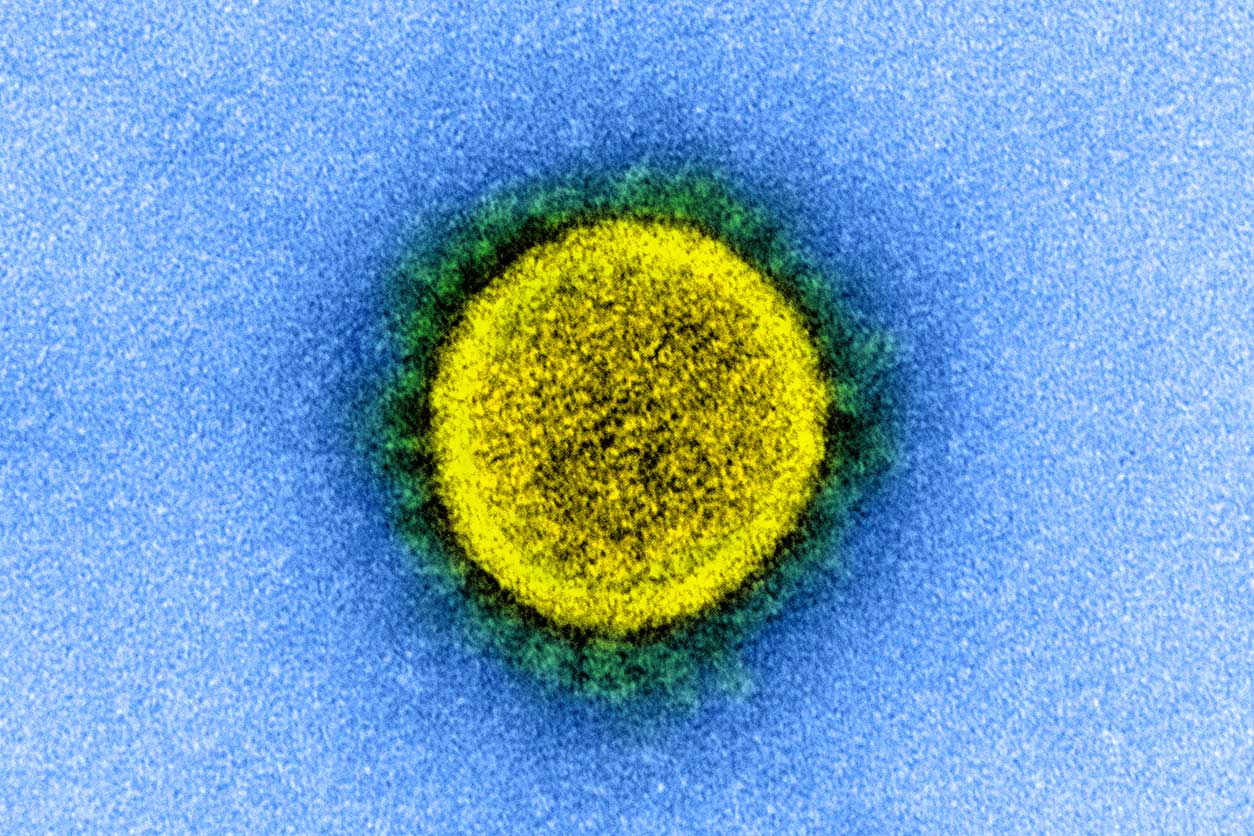 transmission electron micrograph of a SARS-CoV-2 virus particle
