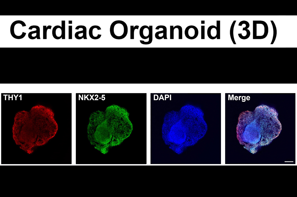 3D cardiac organoid model images