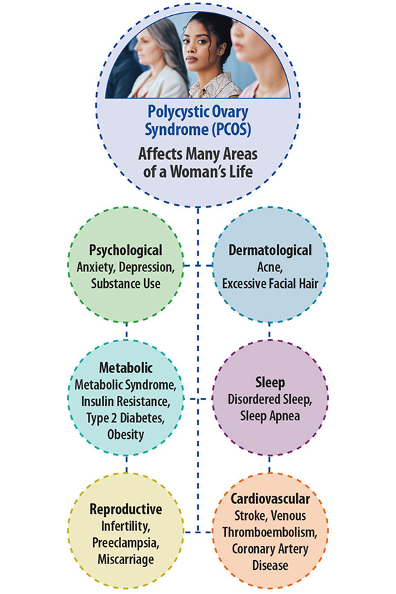 Table that shows the different ways PCOS affects womens' lives