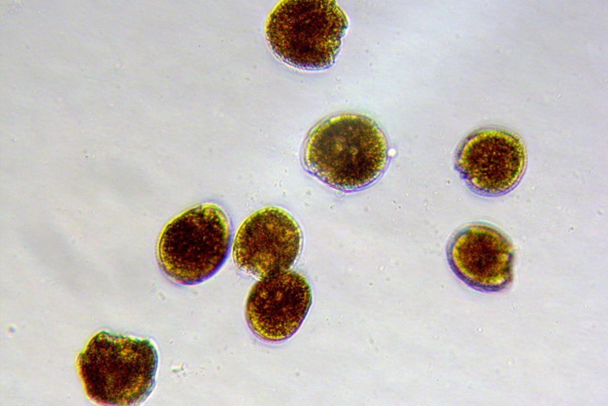 algae species called Gambierdiscus silvae — shown here under light microscopy