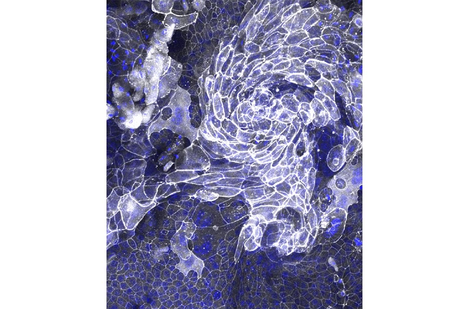 Visualization of cell junctions in tracheal epithelial cells from a TLR5 knockout mouse using ZO1 (white) and DAPI (blue) staining