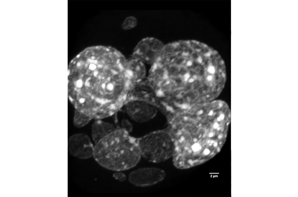 Fluorescently labeled megakaryocytes attached to polylysine-coated glass coverslips with Hoechst 33342. Maximum intensity projection of a stacked image taken with a Carl Zeiss 880 confocal microscope using Plan-Apochromat 63x/1.40 Oil DIC M27 objective and 3.0 digital zoom