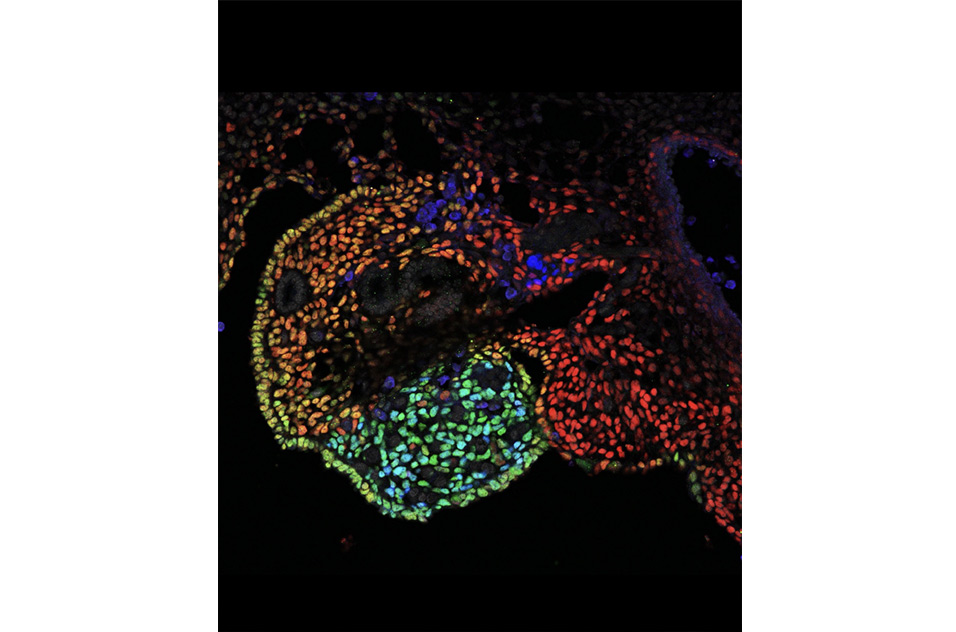 Transverse section of an E11.5 female mouse gonad, stained for COUPTFII (red), SF1 (blue), and WT1 (green)