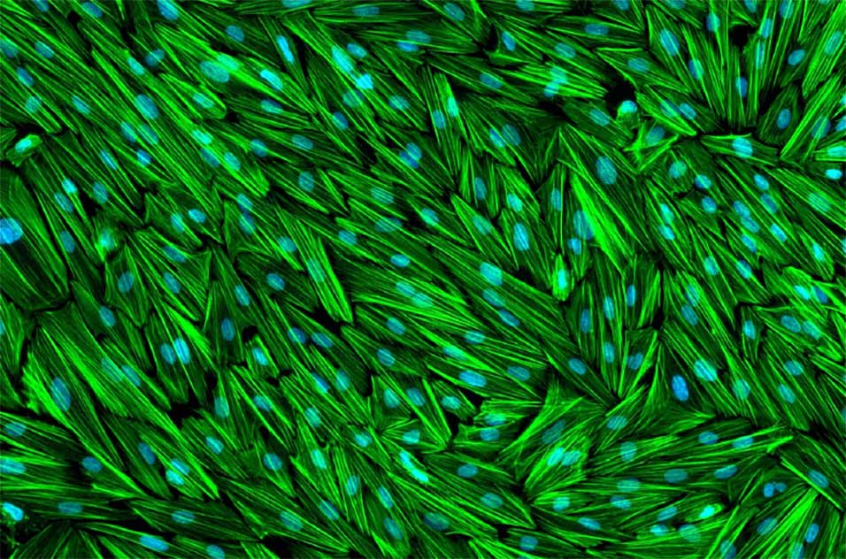 Human endometrial stromal cells were treated for three days with a decidualizing hormone cocktail consisting of 17-beta estradiol, medroxyprogesterone acetate, and cyclic AMP. F-actin filaments were labeled green, and nuclei were labeled blue