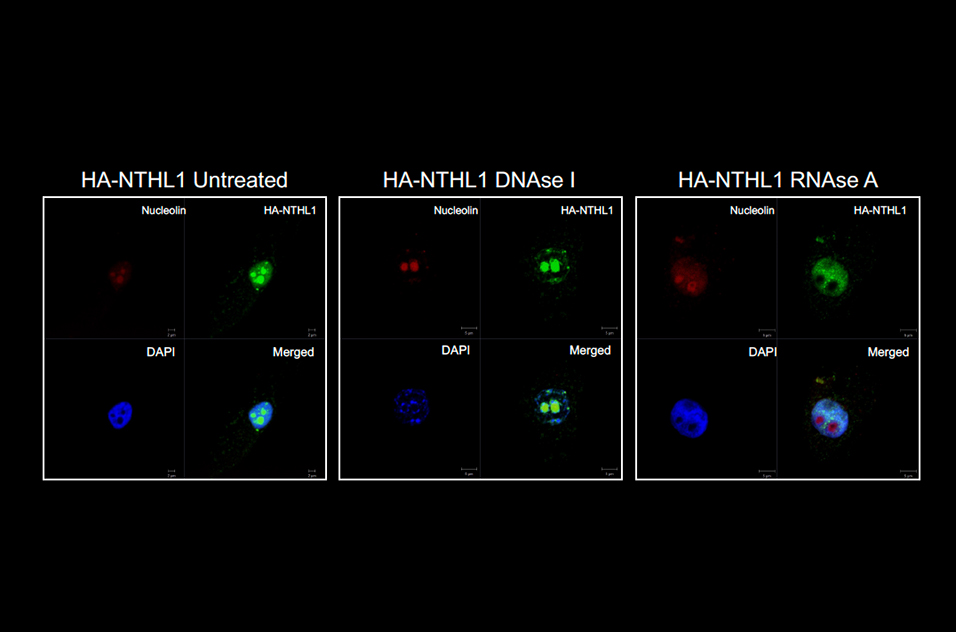 NTHL1 is a bifunctional DNA glycosylase/AP lyase that initiates the repair of oxidatively damaged pyrimidines through recognition and removal of the damaged bases. Loss of NTHL1 expression or function is linked to carcinogenesis. Analysis across different databases shows that in several cancers, NTHL1 is overexpressed. We constructed a NTHL1 overexpression-based cellular model and discovered that NTHL1 functions in ribosome biogenesis