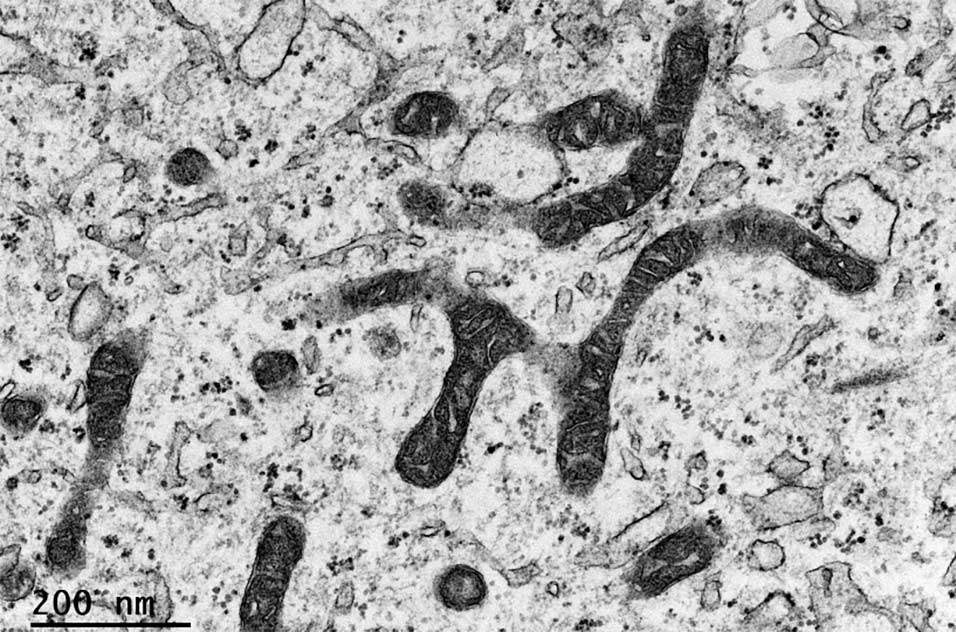 Transmission electron microscopy image of human fibroblasts, showing the mitochondrial morphology