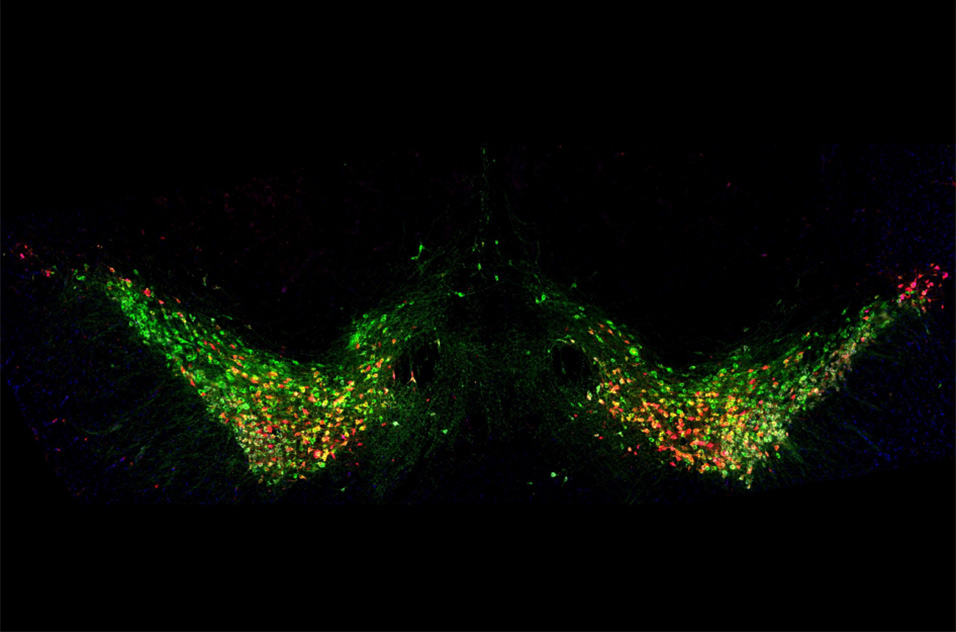 Tyrosine Hydroxylase (TH) positive dopaminergic neurons play a pivotal role in movement and locomotion. This confocal image shows colocalization of fluorophore AAV-mCherry (red) injected in a mouse brain, expressed under the control of cre-recombinase in dopaminergic neurons of Substantia nigra with endogenous expression of TH (green) and Aldh1a1 (magenta)