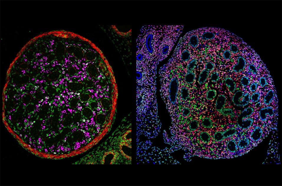 (Left) E17.5 testis cross sections showing perinuclear GFP (green) in COUP-TFII labeled cells at 10.5, Leydig cells (magenta), and smooth muscle actin (red). (Right) E17.5 testis cross sections showing perinuclear GFP (green) in Wt1 labeled cells at 11.5 and 12.5, COUP-TFII (red), and DAPI (blue)