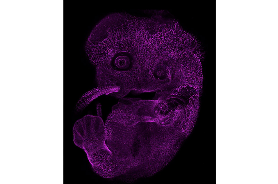 3D projection of a mouse embryo, stained for PECAM-1, a protein that plays a key role in vascular biology and inflammation