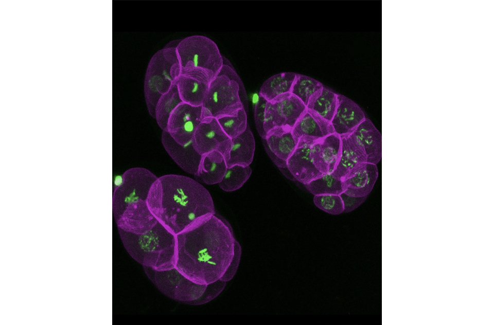 Transgenic Caenorhabditis elegans (worm) early embryos, with histones in green and cell membranes in magenta