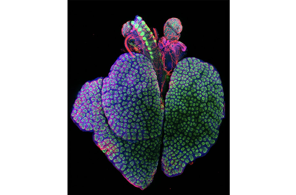 Whole mount of a mouse lung and trachea, stained with SOX9 (green), vasculature (red), and DAPI (blue)