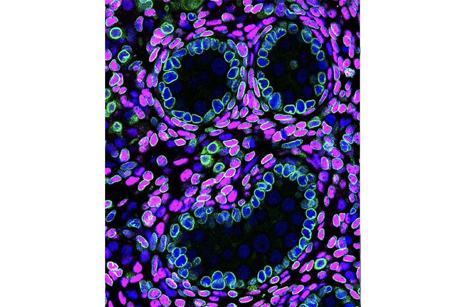 Magnification in testicular cords resembling a smiley face. DAPI in blue, GFP in green, and COUP-TFII in red